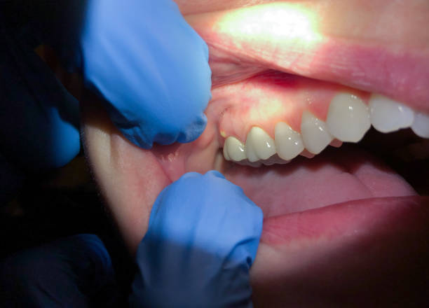 Best Broken or Cracked Tooth Emergency Dentist in Mcminnville, TN